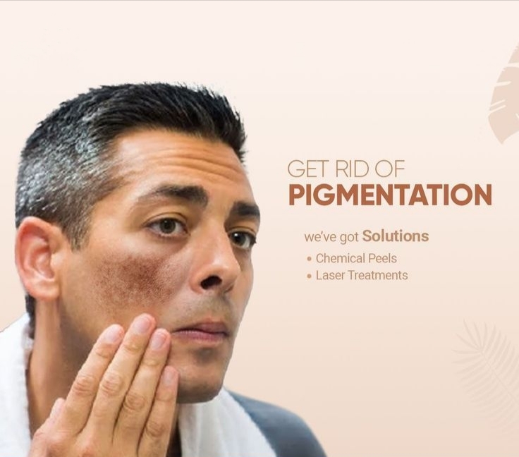 PIGMENTATION \ MELASMA  TREATMENT
